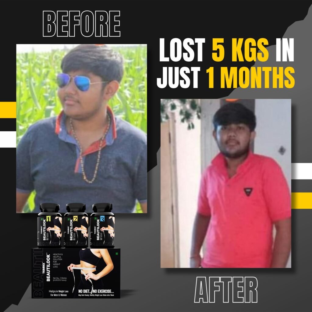 Weightloss Before After 04