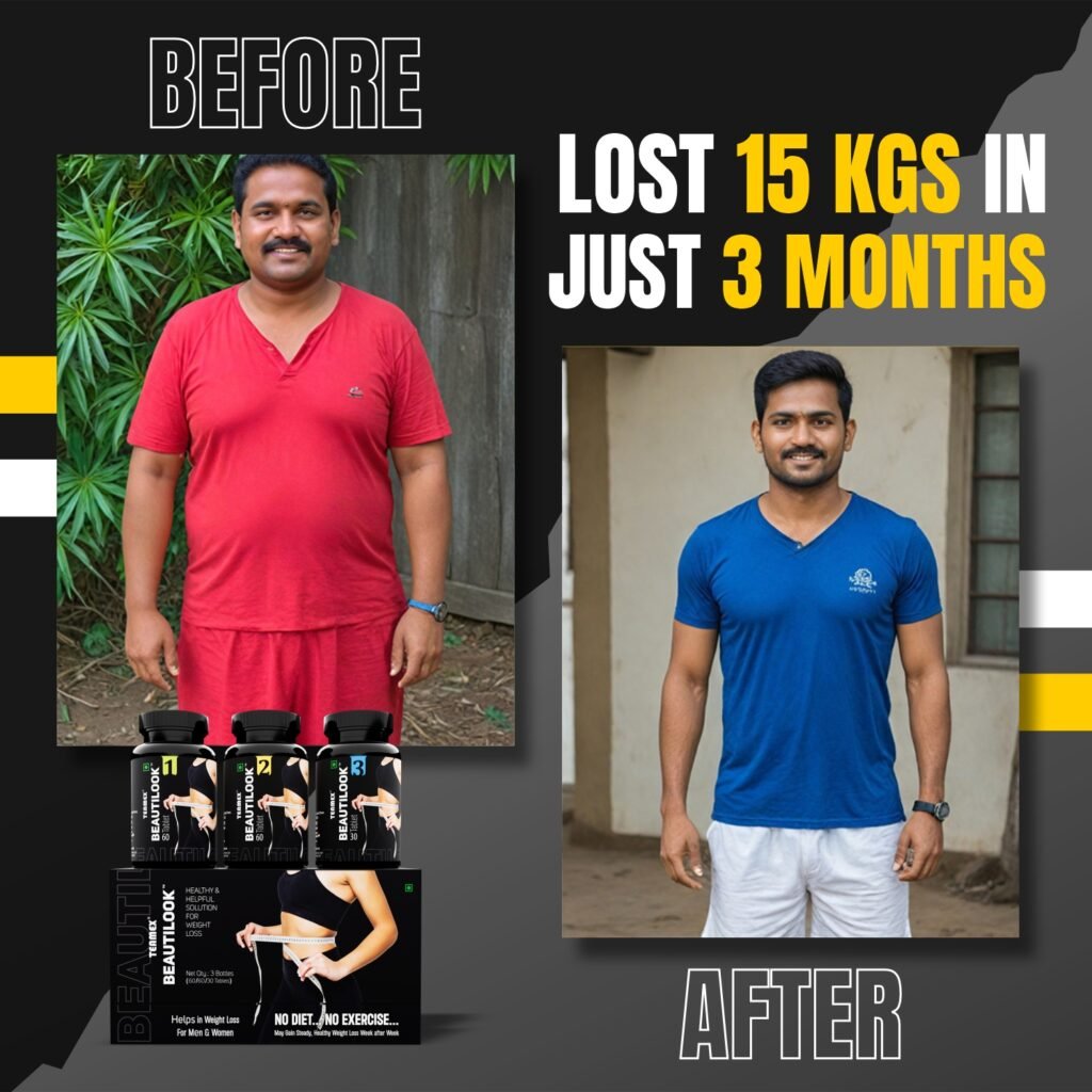 Weightloss Before After 07