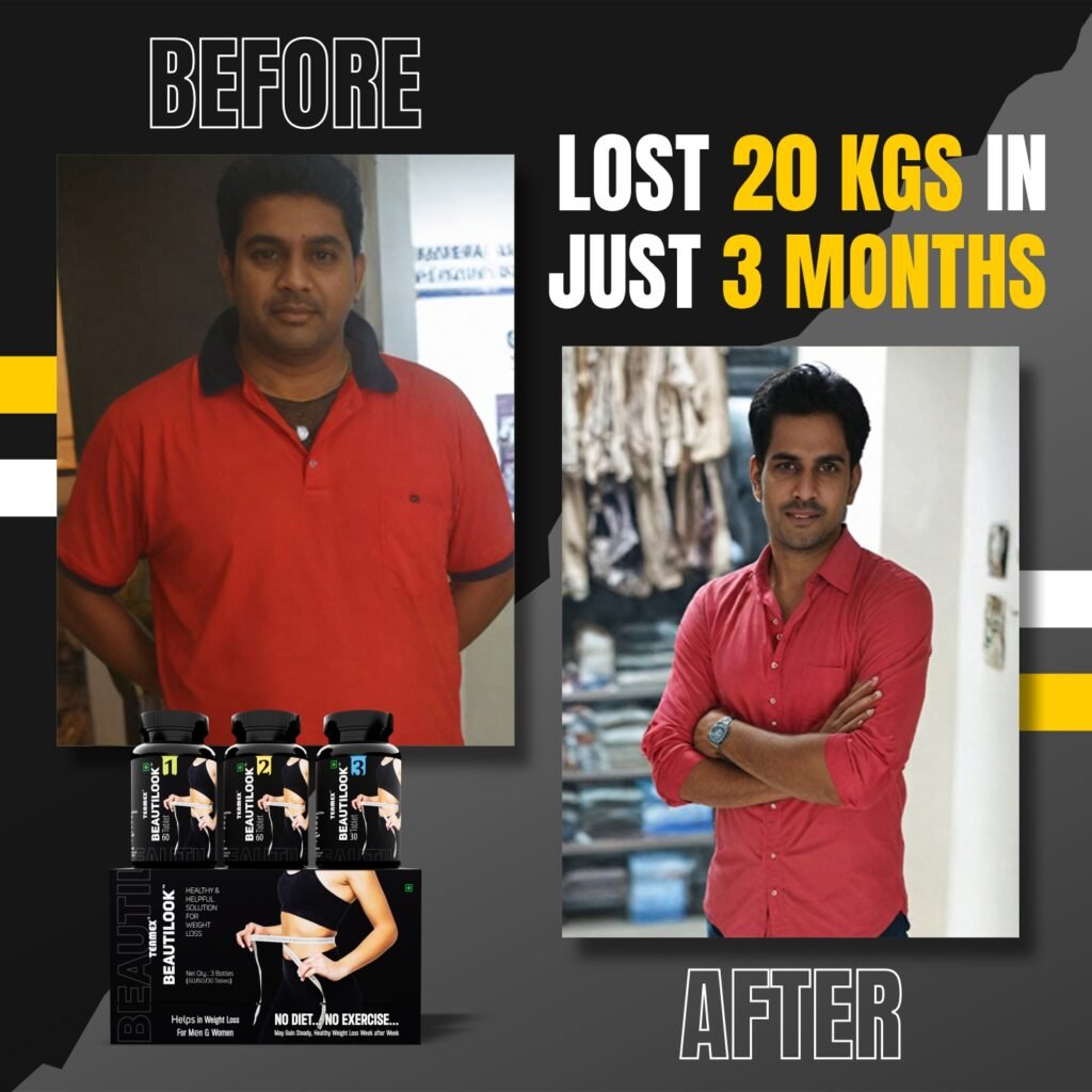 Weightloss Before After 09