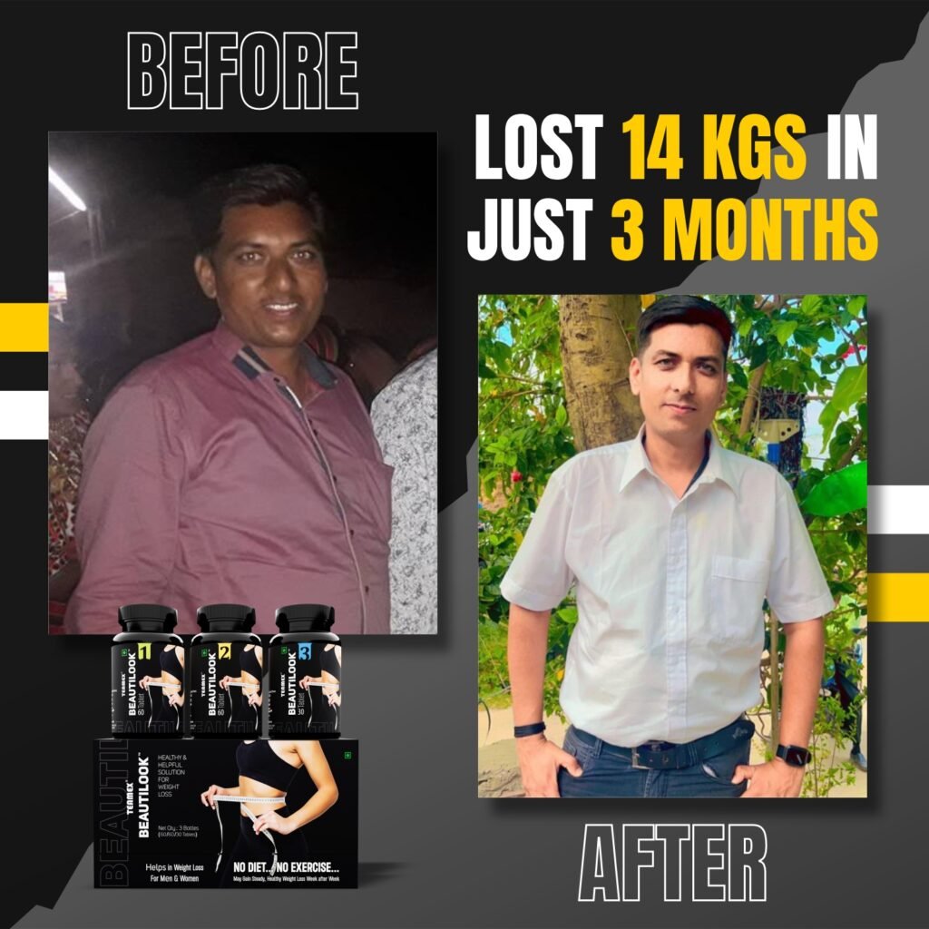 Weightloss Before After 13