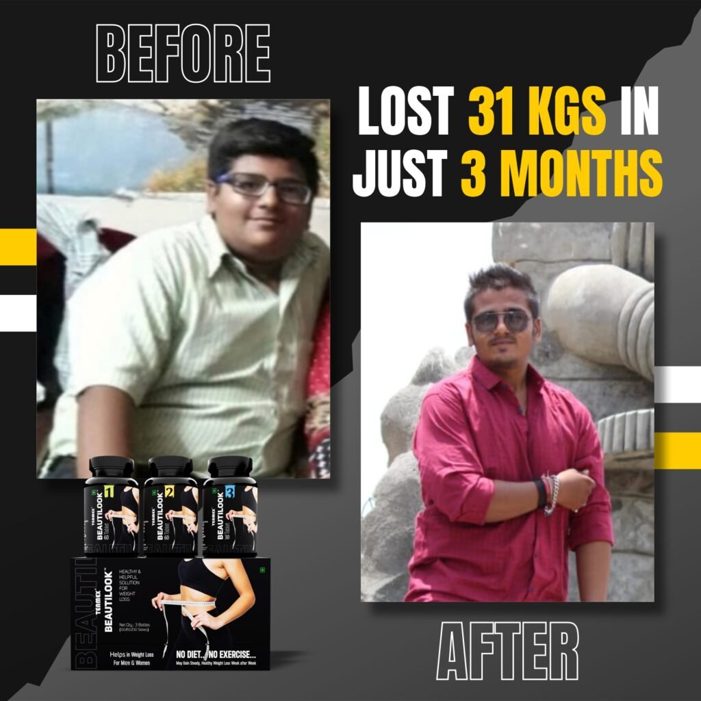 Weightloss Before After 14